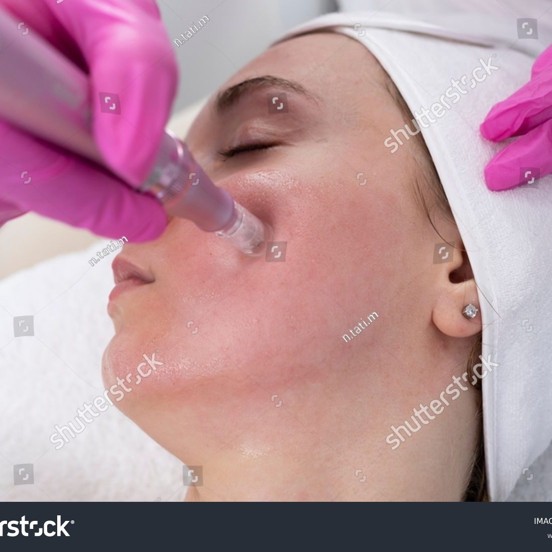 stock-photo-closeup-cosmetologist-making-mesotherapy-injection-with-dermapen-on-face-cheek-area-of-young-woman-2353052543